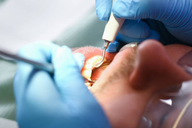 Best Emergency Gum Treatment in Becker, MN