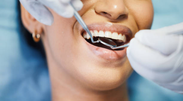 Best Emergency Wisdom Teeth Removal in Becker, MN